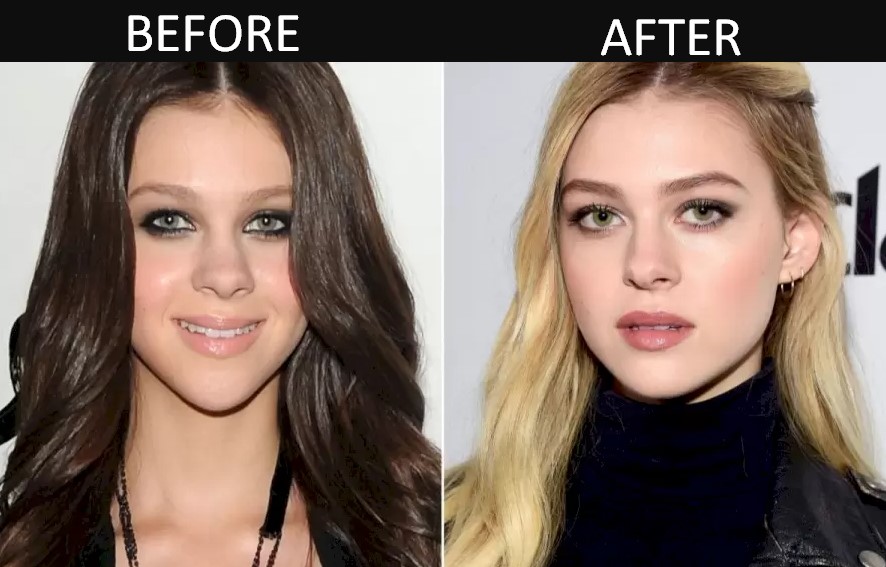 Nicola-Peltz-Plastic-Surgery-Before-and-After-2